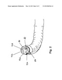 NAVIGATION OF ENDOSCOPIC DEVICES BY MEANS OF EYE-TRACKER diagram and image