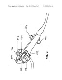 NAVIGATION OF ENDOSCOPIC DEVICES BY MEANS OF EYE-TRACKER diagram and image