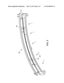 SYSTEM AND METHOD OF NOTCH FILTRATION FOR DUAL ENERGY CT diagram and image