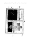 Ultrasound Browser diagram and image