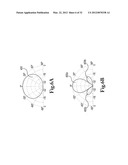 METHOD AND APPARATUS FOR KILLING MICROBES ON SURFACES WITH AN APPLIED     ELECTRIC FIELD diagram and image