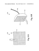 METHOD AND APPARATUS FOR KILLING MICROBES ON SURFACES WITH AN APPLIED     ELECTRIC FIELD diagram and image