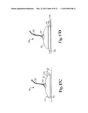 METHOD AND APPARATUS FOR KILLING MICROBES ON SURFACES WITH AN APPLIED     ELECTRIC FIELD diagram and image