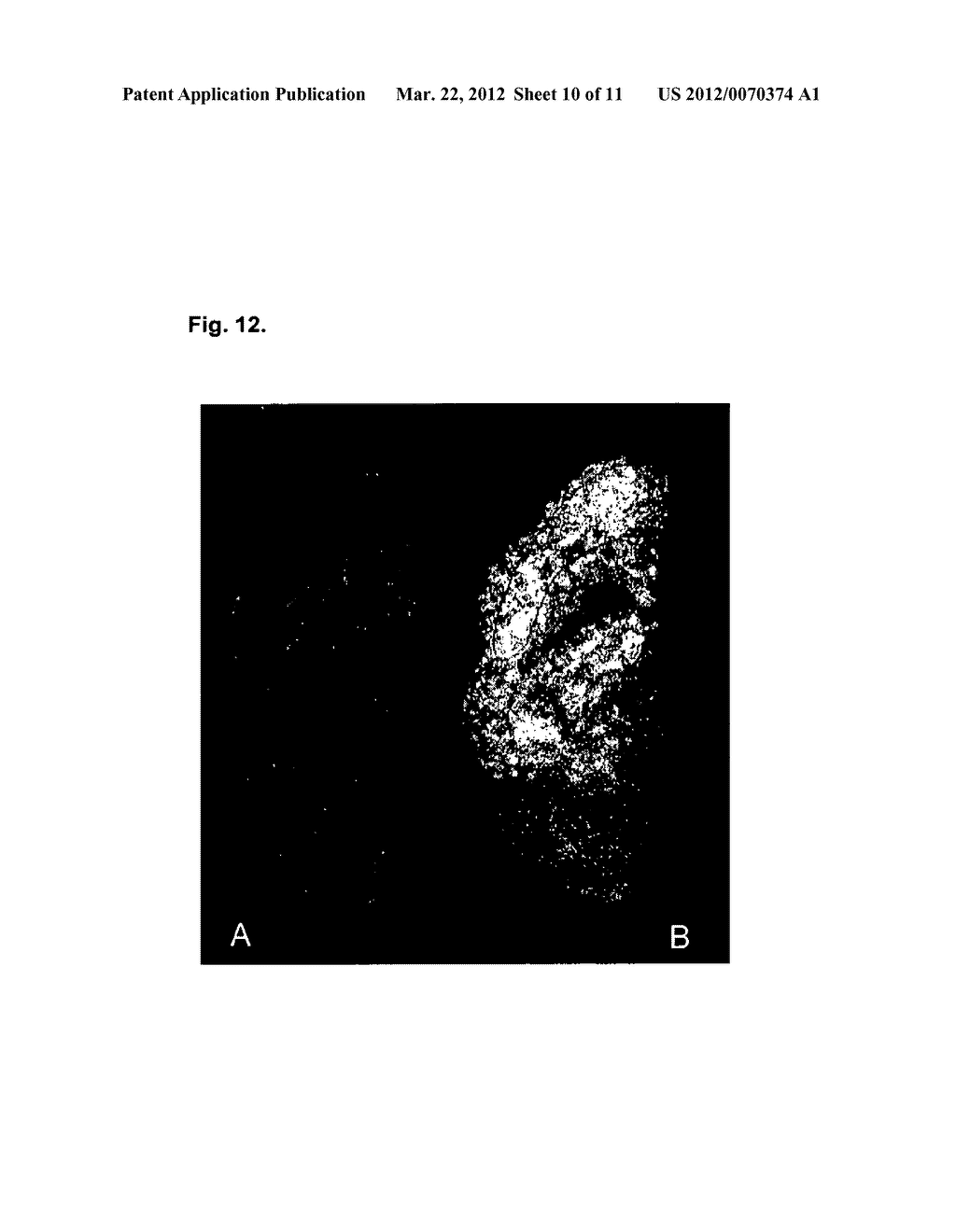 Compounds for Non-Invasive Measurement of Aggregates of Amyloid Peptides - diagram, schematic, and image 11