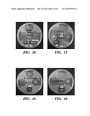 Topical drug delivery system with dual carriers diagram and image