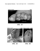 Topical drug delivery system with dual carriers diagram and image