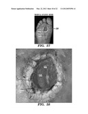 Topical drug delivery system with dual carriers diagram and image