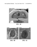 Topical drug delivery system with dual carriers diagram and image