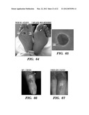 Topical drug delivery system with dual carriers diagram and image