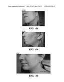 Topical drug delivery system with dual carriers diagram and image