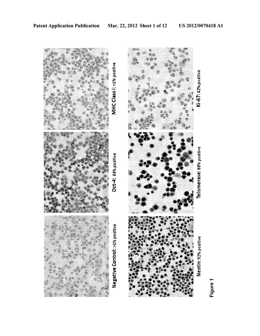 STEM CELLS FOR MUSCULOSKELETAL TISSUE REPAIR - diagram, schematic, and image 02