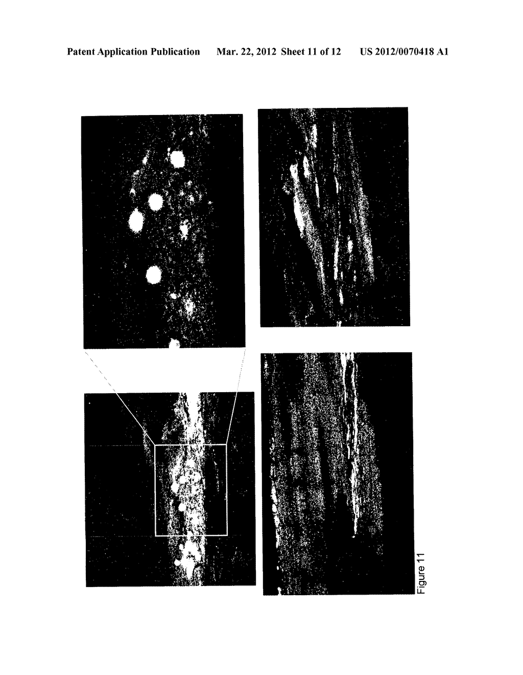 STEM CELLS FOR MUSCULOSKELETAL TISSUE REPAIR - diagram, schematic, and image 12