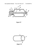 Reduced profile medical balloon element diagram and image