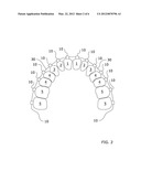 Orthodontic Appliance diagram and image