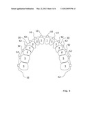 Orthodontic Appliance diagram and image