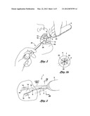 Method and apparatus for reducing pain and patient discomfort at an     injection site diagram and image