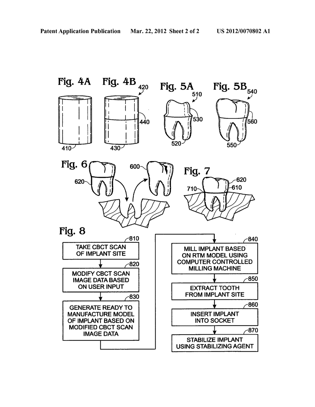 Dental implant fabrication and insertion methods and personalized dental     implant for use therein - diagram, schematic, and image 03
