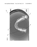 PROSTHESIS MANIPULATION IN DENTAL PROSTHESIS DESIGN diagram and image