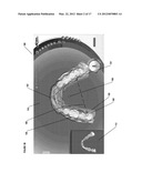 PROSTHESIS MANIPULATION IN DENTAL PROSTHESIS DESIGN diagram and image