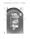 PROSTHESIS MANIPULATION IN DENTAL PROSTHESIS DESIGN diagram and image