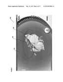 PROSTHESIS MANIPULATION IN DENTAL PROSTHESIS DESIGN diagram and image