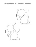 PROSTHESIS MANIPULATION IN DENTAL PROSTHESIS DESIGN diagram and image