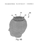 HEAD MODEL FOR BRAIN-IMAGING DEVICE AND TECHNIQUE FOR PRODUCING SAME diagram and image