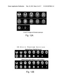 HEAD MODEL FOR BRAIN-IMAGING DEVICE AND TECHNIQUE FOR PRODUCING SAME diagram and image