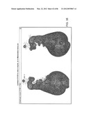 Method For Detecting And Purifying Pancreatic Beta Cells diagram and image