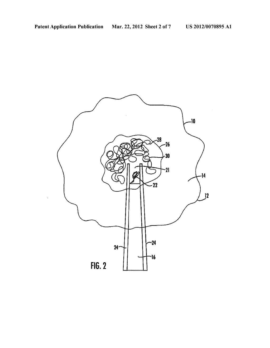 METHOD AND APPARATUS FOR SUSTAINING VIABILITY OF BIOLOGICAL CELLS ON A     SUBSTRATE - diagram, schematic, and image 03