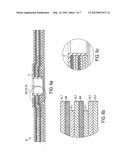 WEARABLE BACKING FOR AN ABRASIVE FLAP DISK diagram and image