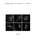 POLYMERIZATION-BASED AMPLIFICATION FOR IMMUNOSTAINING AND BIODETECTION diagram and image