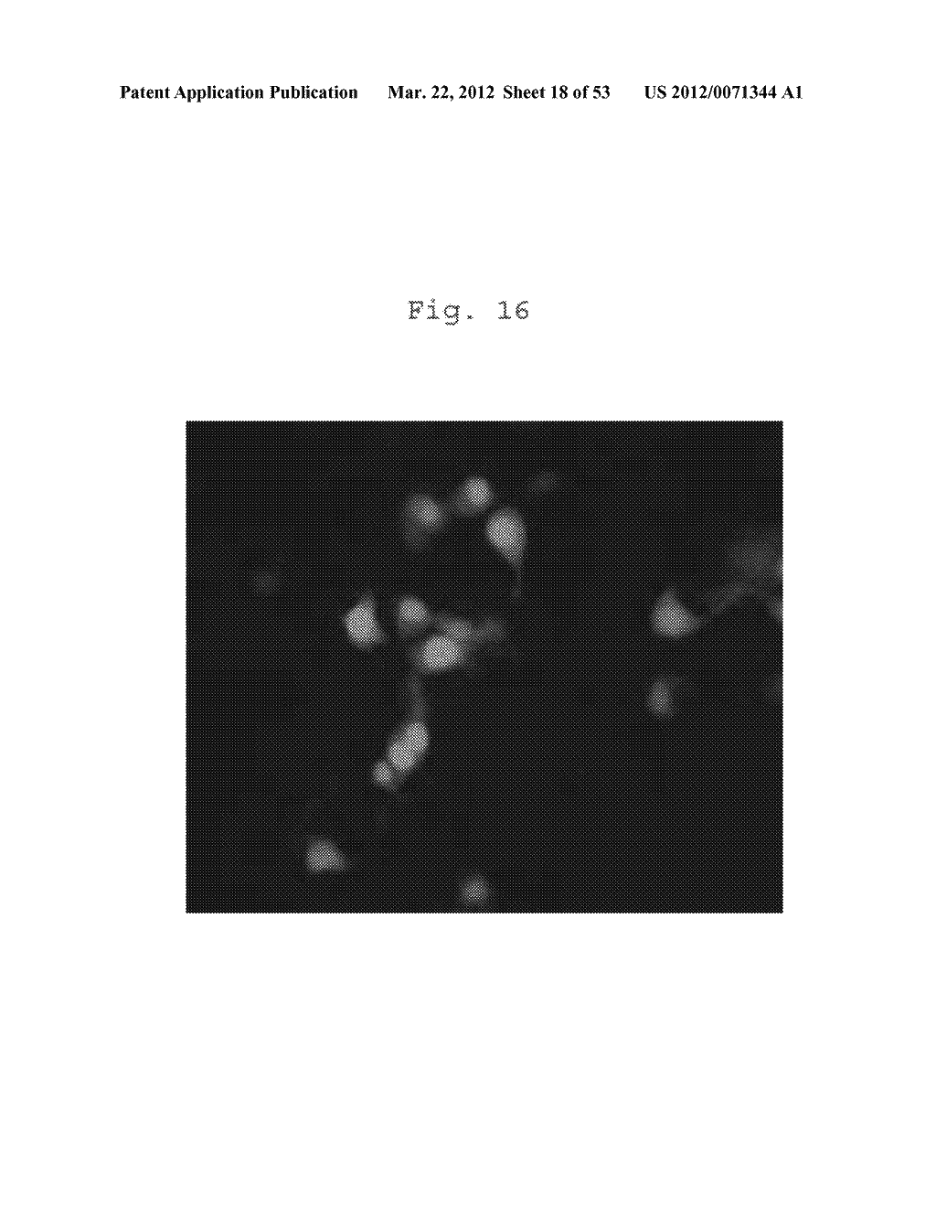 COMPOSITIONS AND METHODS FOR IDENTIFYING ENZYME AND TRANSPORT PROTEIN     INHIBITORS - diagram, schematic, and image 19