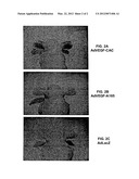 MODIFIED VEGF-A WITH IMPROVED ANGIOGENIC PROPERTIES diagram and image