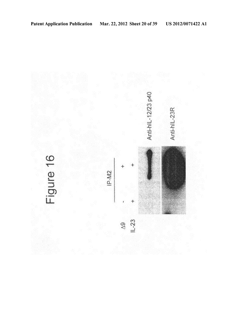 Therapeutic application of isolated naturally-occuring soluble truncated     forms of IL-23 receptor - diagram, schematic, and image 21