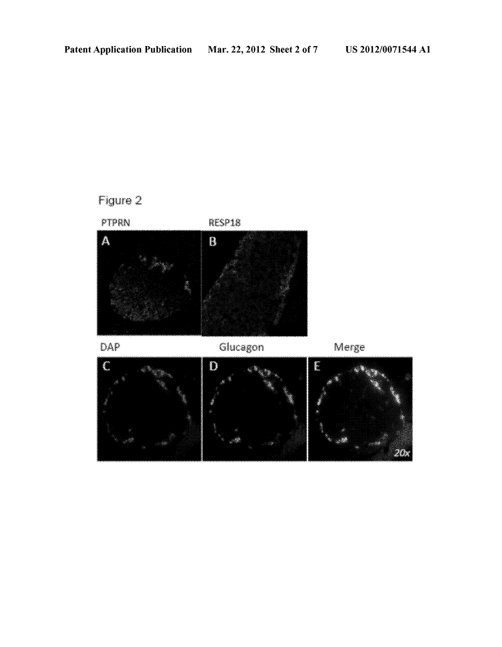 Methods For Identifying Compounds Effective To Increase The Expression Or     Activity Of Aspartyl Aminopeptidase In Mammalian Pancreatic Islet Cells,     And Methods For Decreasing Angiotensin II Levels In Mammalian Pancreatic     Islet Cells - diagram, schematic, and image 03