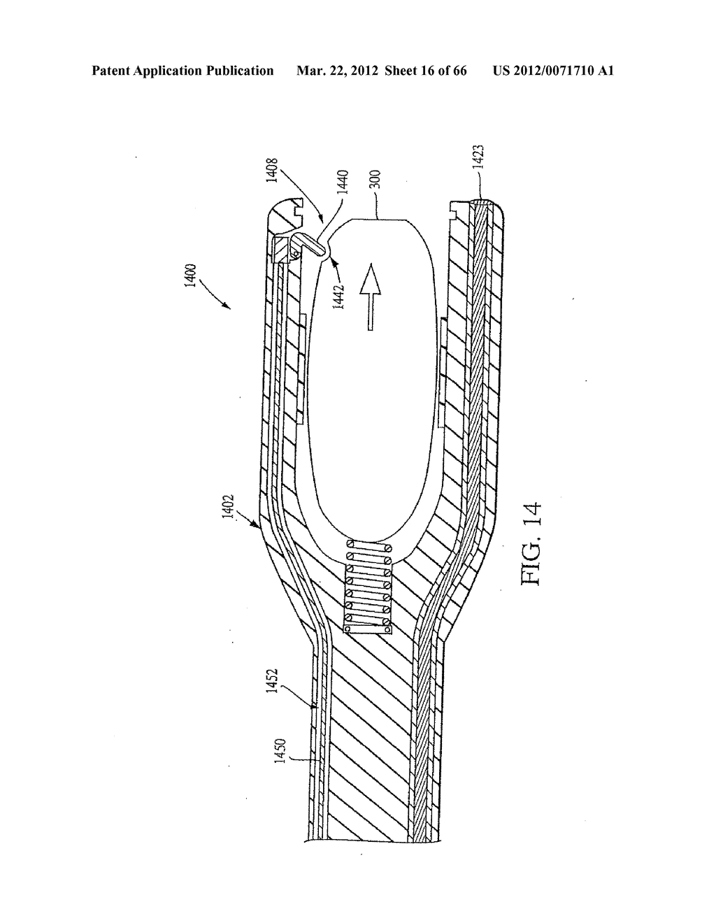 ENDOSCOPIC SMART PROBE AND METHOD - diagram, schematic, and image 17