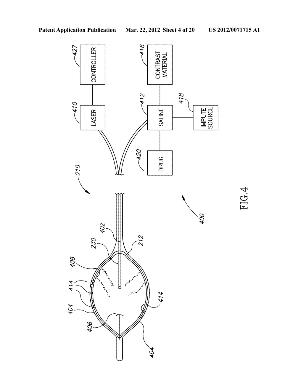 MATERIAL DELIVERY SYSTEM - diagram, schematic, and image 05