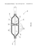 MATERIAL DELIVERY SYSTEM diagram and image