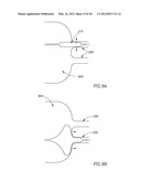 MATERIAL DELIVERY SYSTEM diagram and image