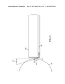 METHOD FOR PROVIDING SURGICAL ACCESS diagram and image