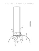 METHOD FOR PROVIDING SURGICAL ACCESS diagram and image