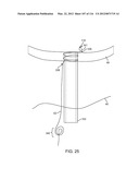 METHOD FOR PROVIDING SURGICAL ACCESS diagram and image