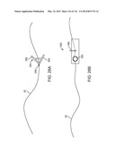 METHOD FOR PROVIDING SURGICAL ACCESS diagram and image