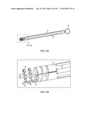 METHOD FOR PROVIDING SURGICAL ACCESS diagram and image