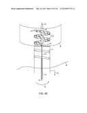 METHOD FOR PROVIDING SURGICAL ACCESS diagram and image