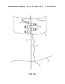 METHOD FOR PROVIDING SURGICAL ACCESS diagram and image