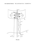 METHOD FOR PROVIDING SURGICAL ACCESS diagram and image