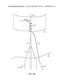 METHOD FOR PROVIDING SURGICAL ACCESS diagram and image