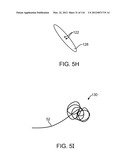 METHOD FOR PROVIDING SURGICAL ACCESS diagram and image